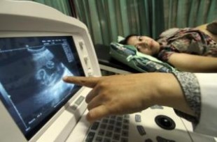 A pregnant woman undergoes a free USG check organized by NGO Rumah Zakat in Jakarta on May 25. In Indonesia, 15.5 babies out of every 100 live births are born too early — about 676,000 babies annually. (Antara Photo/M. Agung Rajasa)